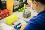 Česká DIANA Biotechnologies dokončila validaci nových testů ze slin